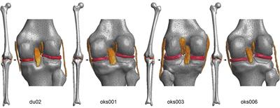 A Parameter Sensitivity Analysis on Multiple Finite Element Knee Joint Models